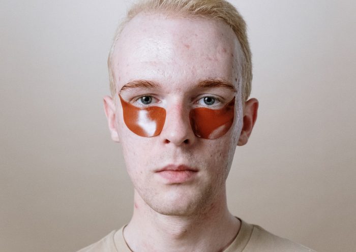 self-healing hydrogel