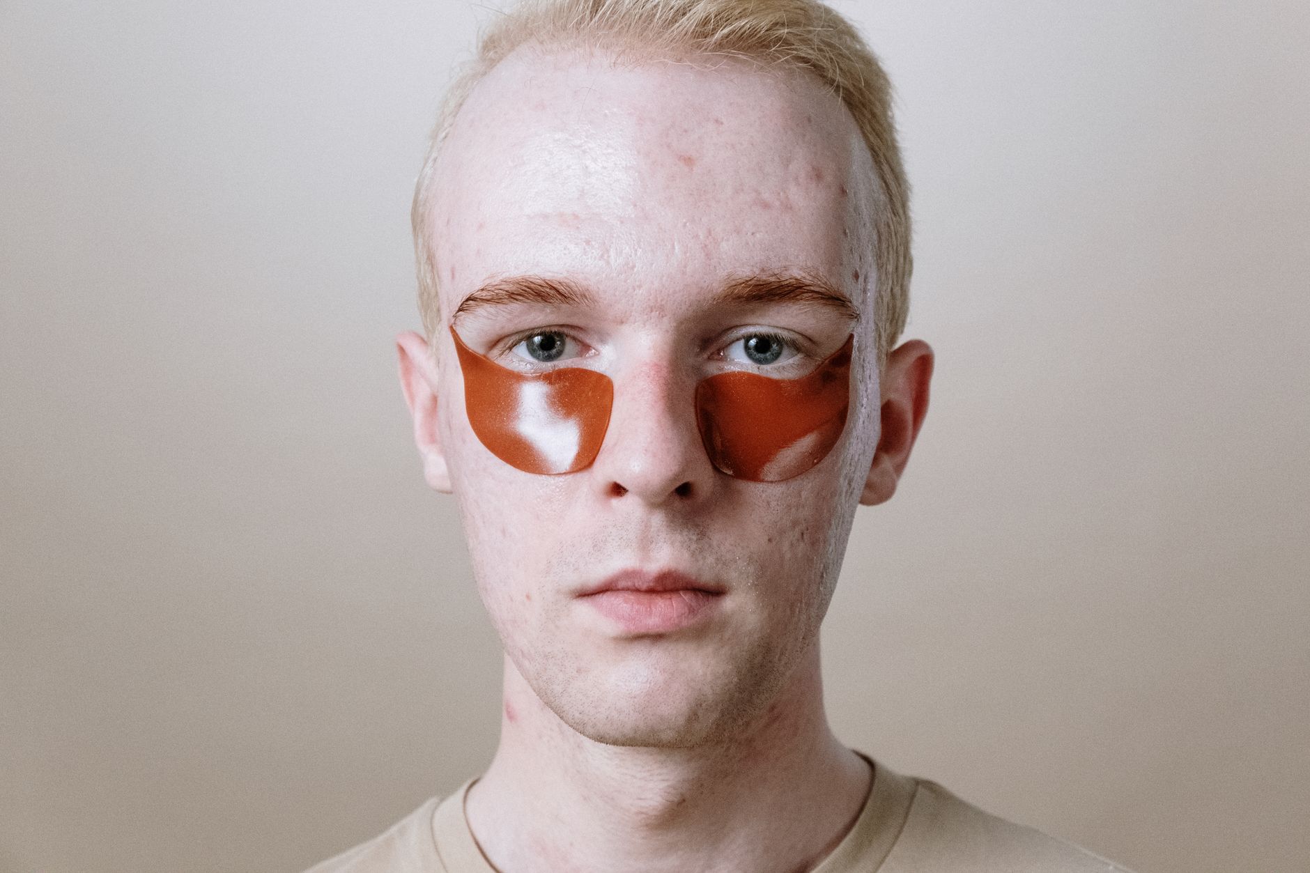 self-healing hydrogel
